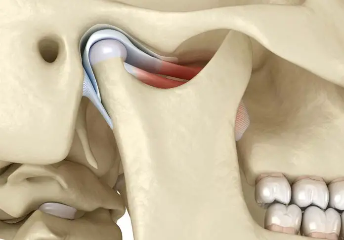TMJ disorder